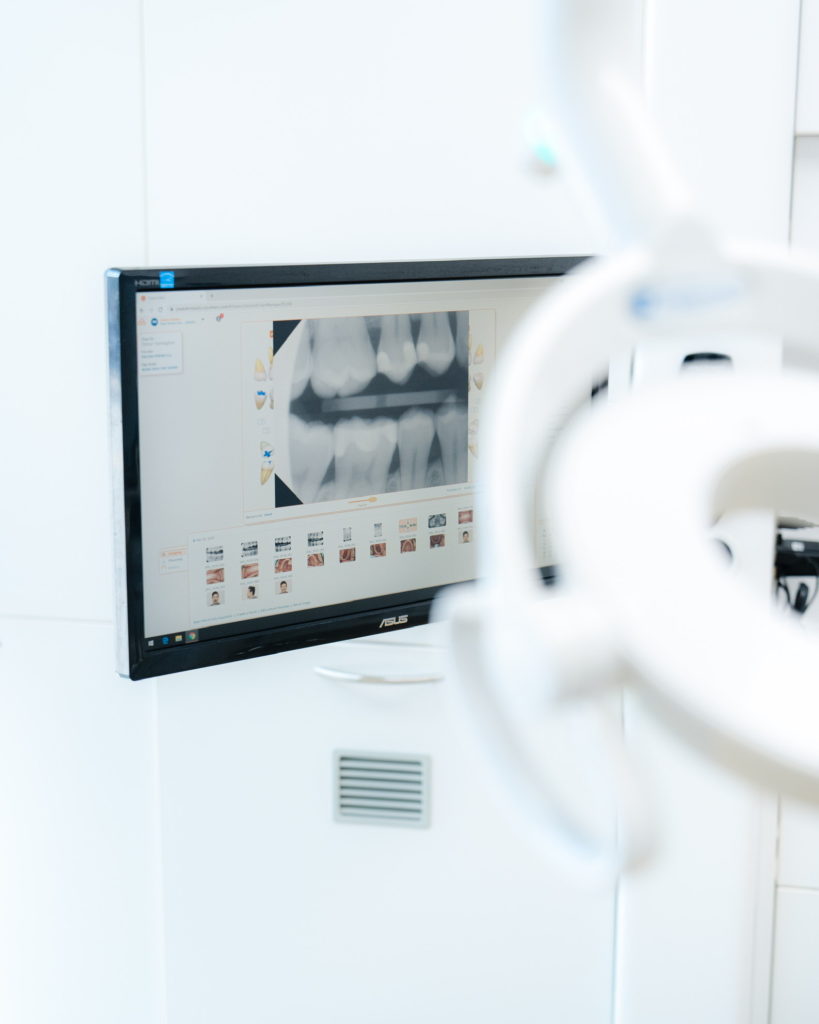 Dental XRay | North Vancouver Dental Clinic